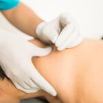 Dry needling